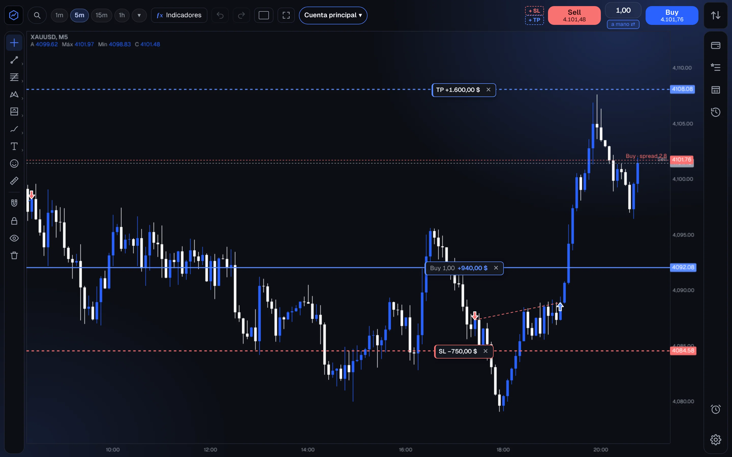 El gráfico de RCM Trader Hub con una operación abierta, su stop loss y su take profit